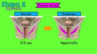 Elevador del ano
Normal Embarazo
3-5 mm Hipertrofia
 