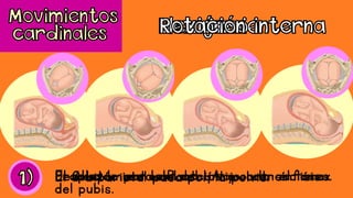 Producido por la P del LA y contracciones.El mentón en contacto íntimo con el tóraxDesplazamiento del occipucio a la sínfisis
del pubis.
El Ø biparietal pasa por la pelvis.
 
