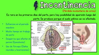 (Pérdida involuntaria de orina)
Es rara en los primeros días del parto, pero hay posibilidad de aparición luego del
parto. Se produce porque el suelo pélvico se ve afectado.
• Esfuerzos en el periodo
expulsivo
• Mucho tiempo en trabajo
de parto
• Desgarros que afectan al
periné (Episiotomía)
• Uso de fórceps (Daños
neurales y laceraciones)
 