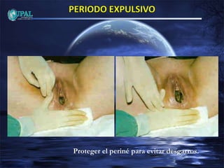 Proteger el periné para evitar desgarros.
 