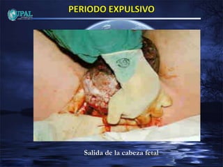 Salida de la cabeza fetal
 