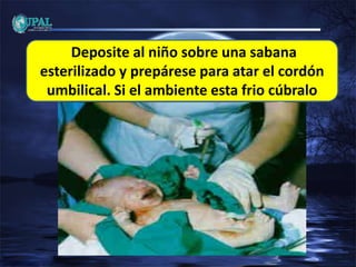 Deposite al niño sobre una sabana
esterilizado y prepárese para atar el cordón
umbilical. Si el ambiente esta frio cúbralo
 
