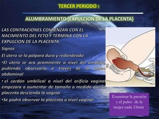 Examinar la presión
y el pulso de la
mujer cada 15min.
 