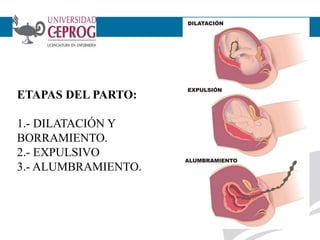 ETAPAS DEL PARTO:
1.- DILATACIÓN Y
BORRAMIENTO.
2.- EXPULSIVO
3.- ALUMBRAMIENTO.
3
 