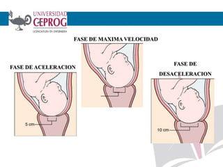 7 cm
FASE DE ACELERACION
FASE DE MAXIMA VELOCIDAD
FASE DE
DESACELERACION
 