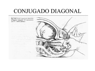 CONJUGADO DIAGONAL 