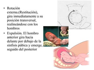Rotación externa.(Restitución), gira inmediatamente a su posición transversal, realineándose con los hombros Expulsión. El hombro anterior gira hacia delante por debajo de la sínfisis púbica y emerge, seguido del posterior 