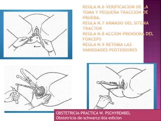 OBSTETRICIA-PRACTICA W. PSCHYREMBEL
Obstetricia-de-schwarcz-6ta-edicion
 