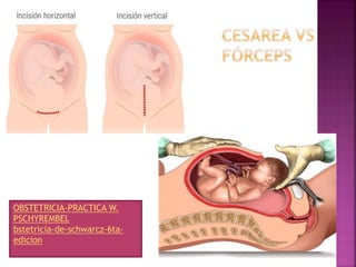 OBSTETRICIA-PRACTICA W.
PSCHYREMBEL
bstetricia-de-schwarcz-6ta-
edicion
 