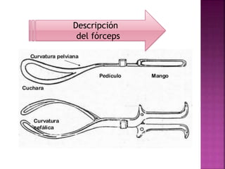 Descripción
del fórceps
 