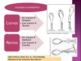 OBSTETRICIA-PRACTICA W. PSCHYREMBEL
Obstetricia-de-schwarcz-6ta-edicion
• Sin tractor
Simpson
• Con tractor
Tarnier
Curvos
• Sin tractor
Kjelland
• Con tractor
Zweifel
Rectos
CRUZADOS O DIVERGENTES
 