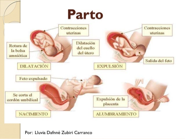 Parto - Puerperio - Repercusiones en el Embarazo