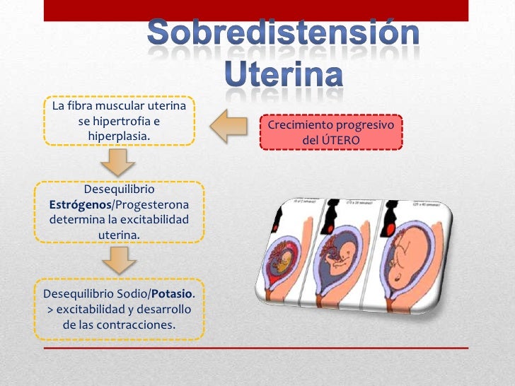 Causas que desencadenan el parto