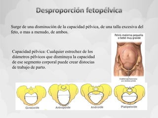 Surge de una disminución de la capacidad pélvica, de una talla excesiva del
feto, o mas a menudo, de ambos.
Capacidad pélvica: Cualquier estrechez de los
diámetros pélvicos que disminuya la capacidad
de ese segmento corporal puede crear distocias
de trabajo de parto.
 