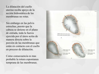 La dilatación del cuello
uterino recibe apoyo de la
acción hidrostática de las
membranas no rotas.
Sin embargo en las pelvis
estrechas, puesto que la
cabeza se detiene en el plano
de entrada, toda la fuerza
ejercida por el útero actúa de
manera directa sobre la
porción de las membranas que
están en contacto con el cuello
en proceso de dilatación.
Como consecuencia es mas
probable la rotura espontanea
temprana de las membranas.
 