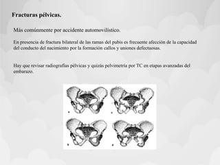 Fracturas pélvicas.
Más comúnmente por accidente automovilístico.
En presencia de fractura bilateral de las ramas del pubis es frecuente afección de la capacidad
del conducto del nacimiento por la formación callos y uniones defectuosas.
Hay que revisar radiografías pélvicas y quizás pelvimetría por TC en etapas avanzadas del
embarazo.
 