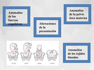 Anomalías
de las
fuerzas
expulsivas Alteraciones
de la
presentación
Anomalías
de la pelvis
ósea materna
Anomalías
de los tejidos
blandos
 