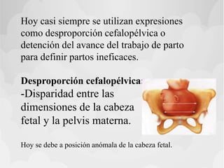 Hoy casi siempre se utilizan expresiones
como desproporción cefalopélvica o
detención del avance del trabajo de parto
para definir partos ineficaces.
Desproporción cefalopélvica:
-Disparidad entre las
dimensiones de la cabeza
fetal y la pelvis materna.
Hoy se debe a posición anómala de la cabeza fetal.
 