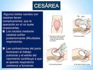 Algunos bebés nacidos con
cesárea tienen
complicaciones, que la
operación en sí no suele
ocasionarlas.
Los nacidos mediante
cesárea sufren
posteriormente dificultades
respiratorias.
Las contracciones del parto
favorecen el trabajo
pulmonar y el estrés del
nacimiento contribuye a que
el aparato respiratorio
comience a funcionar.
 