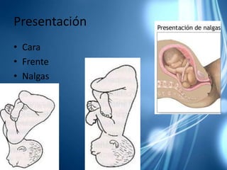 Presentación CaraFrenteNalgas 