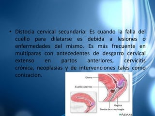 Cirugía vaginal previa 