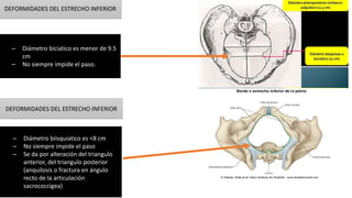 DEFORMIDADES DEL ESTRECHO INFERIOR
– Diámetro biisquiatico es <8 cm
– No siempre impide el paso
– Se da por alteración del triangulo
anterior, del triangulo posterior
(anquilosis o fractura en ángulo
recto de la articulación
sacrococcigea)
DEFORMIDADES DEL ESTRECHO INFERIOR
– Diámetro biciatico es menor de 9.5
cm
– No siempre impide el paso.
 