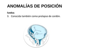 ANOMALÍAS DE POSICIÓN
Fundica:
3. Conocida también como prolapso de cordón.
 
