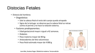 • Distocia de hombros:
• Diagnóstico:
• Sale la cabeza fetal el resto del cuerpo queda atrapado
• Signo de la tortuga: se observa que la cabeza fetal se retrae
contra el periné y no hace la rotación externa.
• Factores predisponentes:
• Edad gestacional mayor o igual a 42 semanas.
• Diabetes
• Peso materno mayor de 90 kg
• Antecedentes de feto voluminoso
• Peso fetal estimado mayor de 4 000 g
Distocias Fetales
Juan Aller, Gustavo Pages. Obstetricia moderna. Tercera edición
 