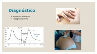 Diagnóstico
 Palpación abdominal
 Tocografía externa
 