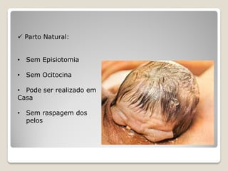  Parto Natural:
• Sem Episiotomia
• Sem Ocitocina
• Pode ser realizado em
Casa
• Sem raspagem dos
pelos
 