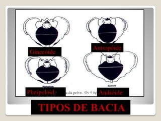TIPOS DE BACIA
Platipelóide Andróide
Antropóide
Ginecóide
 