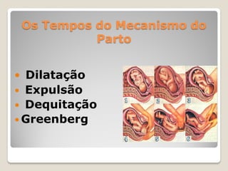 Os Tempos do Mecanismo do
Parto
 Dilatação
 Expulsão
 Dequitação
 Greenberg
 