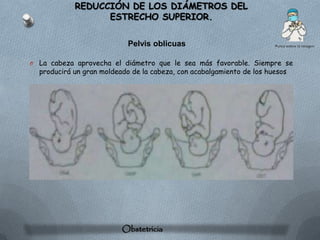 REDUCCIÓN DE LOS DIÁMETROS DEL
                    ESTRECHO SUPERIOR.

                             Pelvis oblicuas

O   La cabeza aprovecha el diámetro que le sea más favorable. Siempre se
    producirá un gran moldeado de la cabeza, con acabalgamiento de los huesos




                           Obstetricia
 