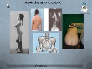 ANOMALÍAS DE LA COLUMNA.




      Obstetricia
 
