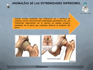 ANOMALÍAS DE LAS EXTREMIDADES INFERIORES.




 Cuando existen anomalías tipo dislocación uni o bilateral de
 caderas, coxitis, fracturas mal consolidadas, poliomelitis, etc. con
 trastornos importantes de la marcha se pueden producir
 anomalías de la pelvis que ocasionan distocia al momento del
 parto.




                          Obstetricia
 