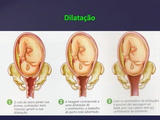 Dilatação
 