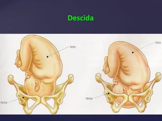 Descida
 