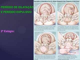 PERÍODO DE DILATAÇÃO
E PERÍODO EXPULSIVO
2º Estágio:
 