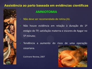 • Não deve ser recomendada de rotina (A).
• Não houve evidência em relação à duração do 1º
estágio do TP, satisfação materna e escores de Apgar no
5º minuto;
• Tendência a aumento do risco de uma operação
cesariana.
Cochrane Review, 2007
Assistência ao parto baseada em evidências científicas
AMNIOTOMIA
 