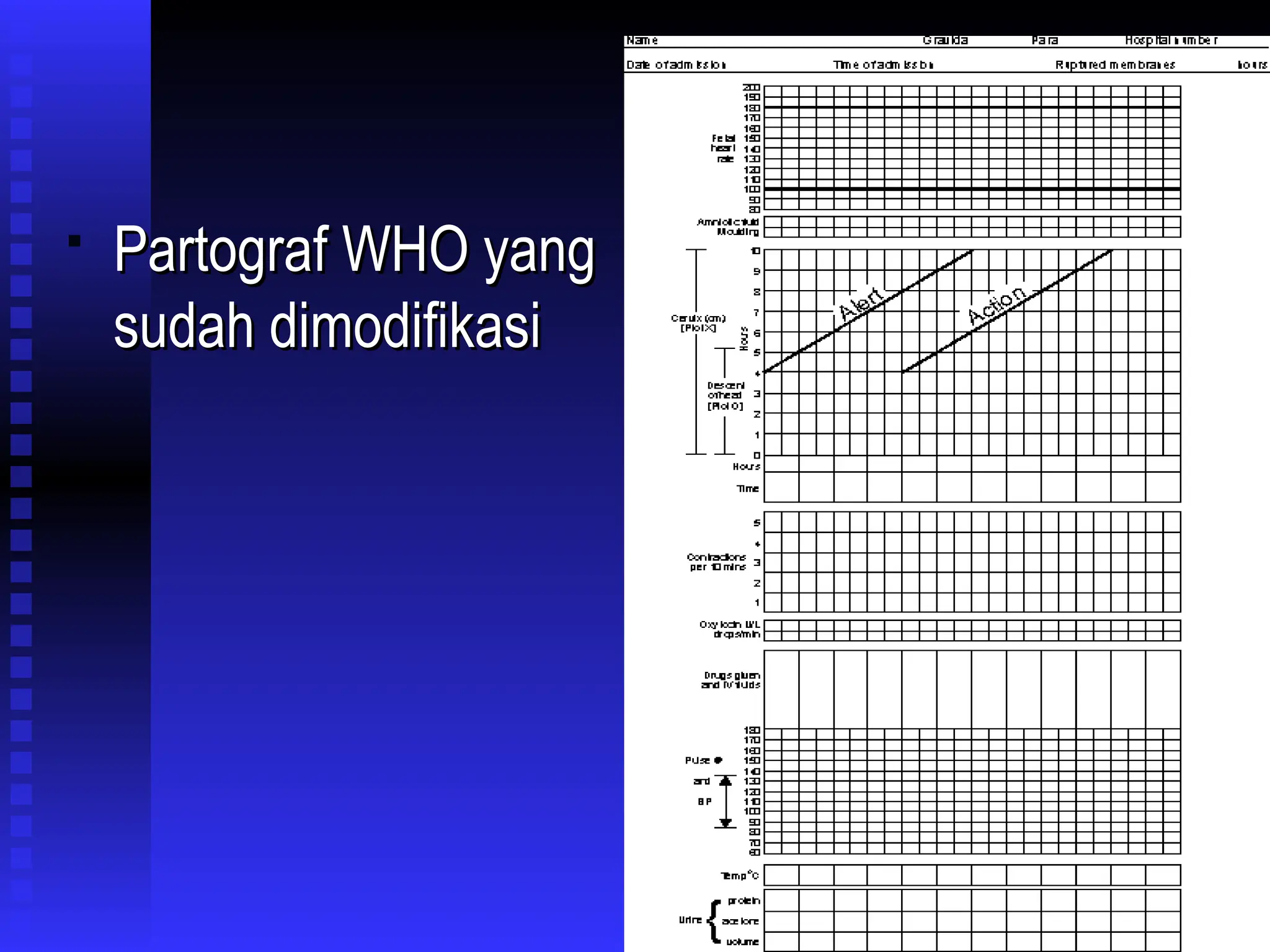 
Partograf WHO yang
Partograf WHO yang
sudah dimodifikasi
sudah dimodifikasi
 