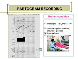 PARTOGRAM RECORDING Mother condition Vital signs – BP, Pulse, T ºC   Urine analysis – acetone,  albumin, glucose  Urine volume Medications or drug given 