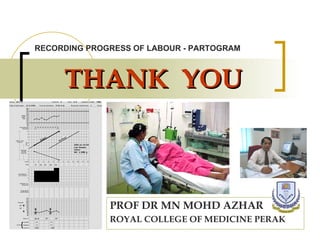 THANK  YOU PROF DR MN MOHD AZHAR ROYAL COLLEGE OF MEDICINE PERAK RECORDING PROGRESS OF LABOUR - PARTOGRAM 