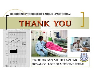 RECORDING PROGRESS OF LABOUR - PARTOGRAM



     THANK YOU



              PROF DR MN MOHD AZHAR
              ROYAL COLLEGE OF MEDICINE PERAK
 