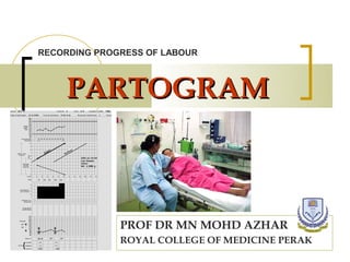 RECORDING PROGRESS OF LABOUR



    PARTOGRAM



              PROF DR MN MOHD AZHAR
              ROYAL COLLEGE OF MEDICINE PERAK
 