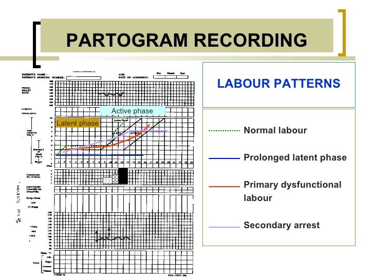 Partograph Chart Download