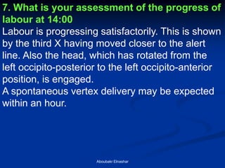 7. What is your assessment of the progress of labour at 14:00 
Labour is progressing satisfactorily. This is shown by the third X having moved closer to the alert line. Also the head, which has rotated from the left occipito-posterior to the left occipito-anterior position, is engaged. 
A spontaneous vertex delivery may be expected within an hour. 
Aboubakr Elnashar  