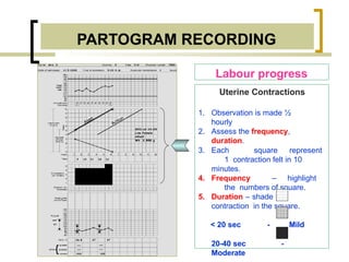 partogram-230420134156-56014911 1010.pptx