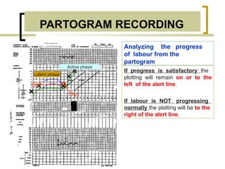 partogram-230420134156-56014911 1010.pptx