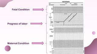 Fetal Condition
Progress of labor
Maternal Condition
 