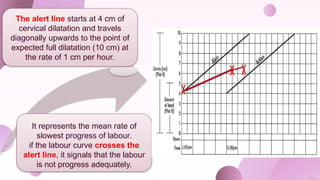 The alert line starts at 4 cm of
cervical dilatation and travels
diagonally upwards to the point of
expected full dilatation (10 cm) at
the rate of 1 cm per hour.
It represents the mean rate of
slowest progress of labour.
if the labour curve crosses the
alert line, it signals that the labour
is not progress adequately.
 